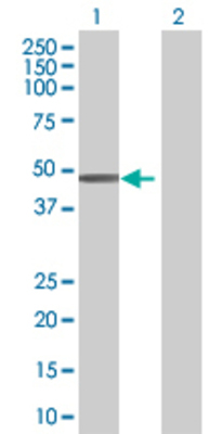 Lane 1: ZNF193 transfected lysate (46 KDa) Lane 2: Non-transfected lysate.