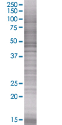 MMP1 transfected lysate