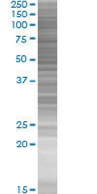 CEACAM6 transfected lysate.