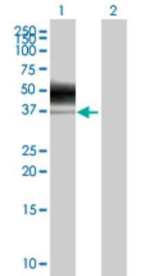 Lane 1: CEACAM6 transfected lysate (37.2 KDa) Lane 2: Non-transfected lysate.