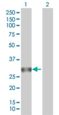 Lane 1: RPIA transfected lysate (26.18 KDa). Lane 2: Non-transfected lysate.