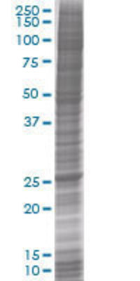 RPIA transfected lysate