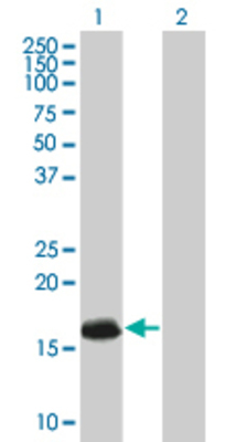Lane 1: ATRX transfected lysate (9.9 KDa) Lane 2: Non-transfected lysate.