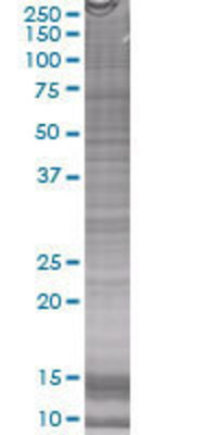 ATRX transfected lysate.