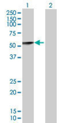 Lane 1: CASQ2 transfected lysate (44 KDa) Lane 2: Non-transfected lysate.