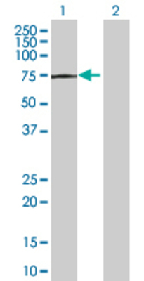 Lane 1: TPP1 transfected lysate (62.04 KDa) Lane 2: Non-transfected lysate.