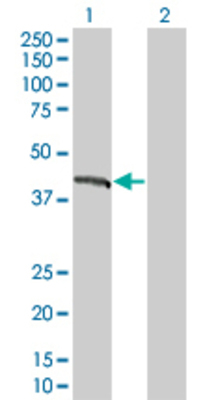 Lane 1: EMD transfected lysate (27.94 KDa) Lane 2: Non-transfected lysate.