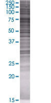 FANCM transfected lysate.