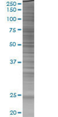 HSPB8 transfected lysate.