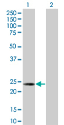 Lane 1: HSPB8 transfected lysate (21.67 KDa) Lane 2: Non-transfected lysate.