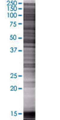 GART transfected lysate.