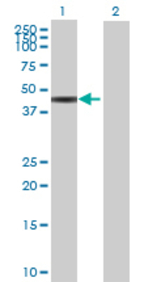 Lane 1: GART transfected lysate (47.74 KDa) Lane 2: Non-transfected lysate.