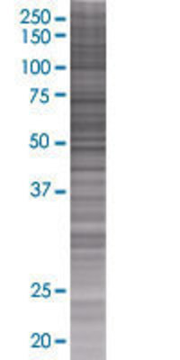OXCT2 transfected lysate.