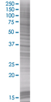 CAB39 transfected lysate
