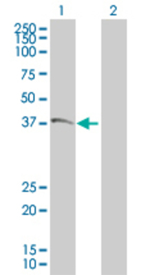 Lane 1: CAB39 transfected lysate (39.9 KDa). Lane 2: Non-transfected lysate.
