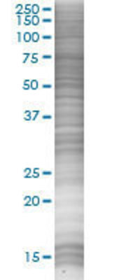 SPSB2 transfected lysate.