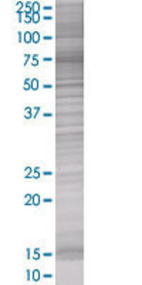 TRIM21 transfected lysate.