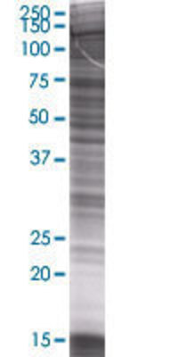 BCR transfected lysate.