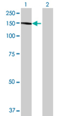 Lane 1: BCR transfected lysate (118.47 KDa) Lane 2: Non-transfected lysate.