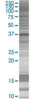 NMI transfected lysate.