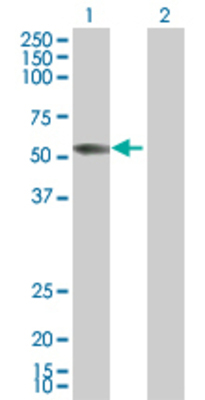 Lane 1: F9 transfected lysate (51.8 KDa) Lane 2: Non-transfected lysate.