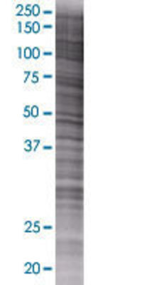 POMP transfected lysate.
