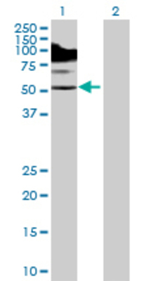 Lane 1: CACNB1 transfected lysate (65.89 KDa) Lane 2: Non-transfected lysate.