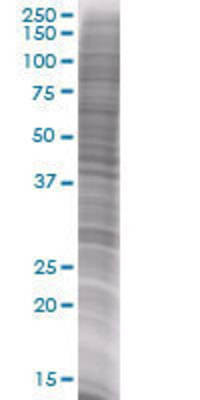 LCN2 transfected lysate.