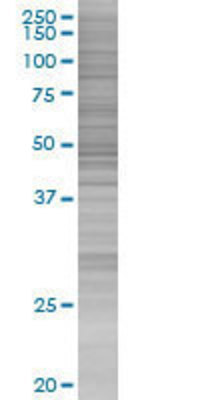 XRCC4 transfected lysate.