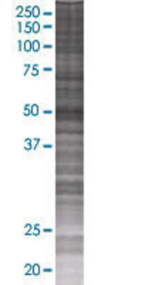 SHMT1 transfected lysate.