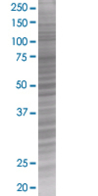 GPRC5D transfected lysate.