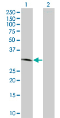 Lane 1: GPRC5D transfected lysate (38.8 KDa) Lane 2: Non-transfected lysate.