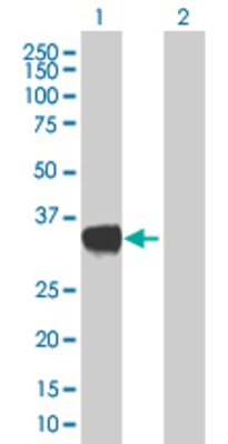 Lane 1: SULT1C1 transfected lysate (32.67 KDa). Lane 2: Non-transfected lysate.