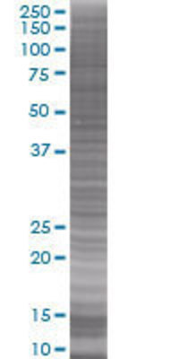 SULT1C1 transfected lysate