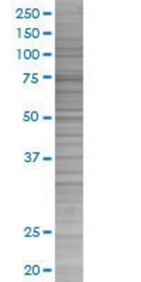 IL2RB transfected lysate.