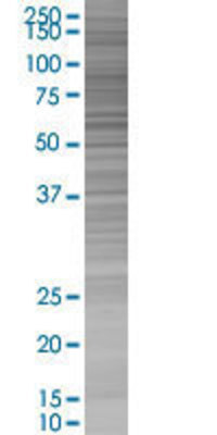 ZNRD1 transfected lysate.