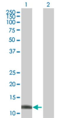 Lane 1: ZNRD1 transfected lysate (13.97 KDa) Lane 2: Non-transfected lysate.