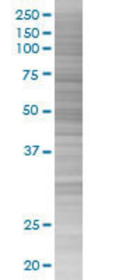 PPOX transfected lysate.