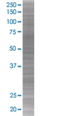 TBRG4 transfected lysate