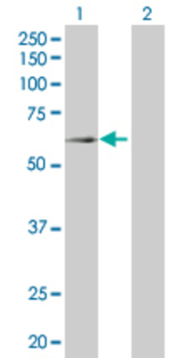 Lane 1: TBRG4 transfected lysate (70.7 KDa). Lane 2: Non-transfected lysate.