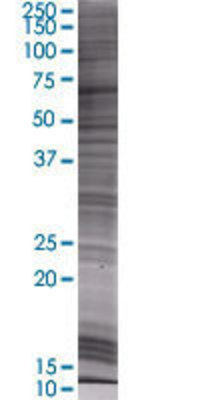VISA transfected lysate.