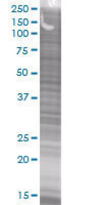 CD1D transfected lysate