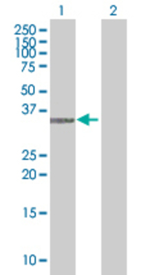 Lane 1: CD1D transfected lysate (36.96 KDa). Lane 2: Non-transfected lysate.