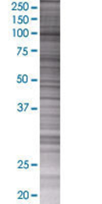 DPP8 transfected lysate.