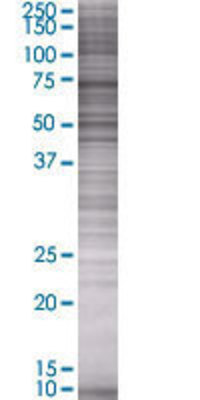 EPHB3 transfected lysate.