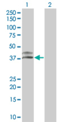 Lane 1: CTSH transfected lysate (36.96 KDa). Lane 2: Non-transfected lysate.