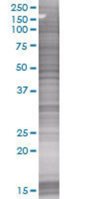 CTSH transfected lysate