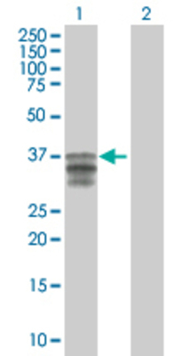 Lane 1: LIF transfected lysate (22 KDa). Lane 2: Non-transfected lysate.
