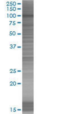 HELLS transfected lysate.