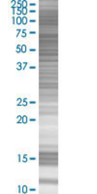 C21orf66 transfected lysate.